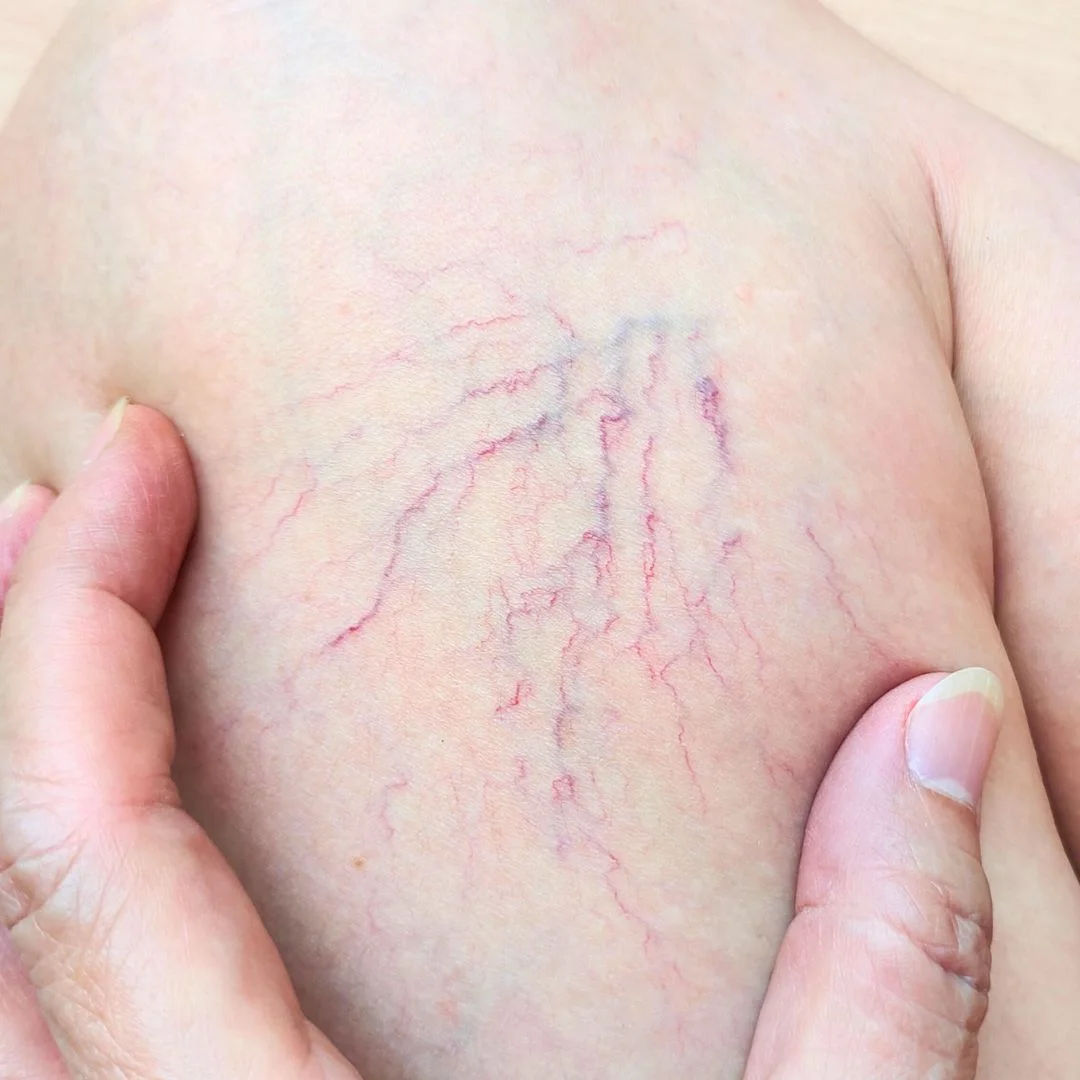 service